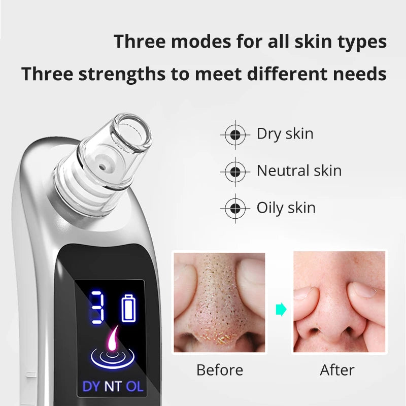 Ali Face & Body Tools DARSONVAL blackheads remover pimples remover tool Acne tools pore vacuum pore cleaner black dot blackhead vacuum skin care tools