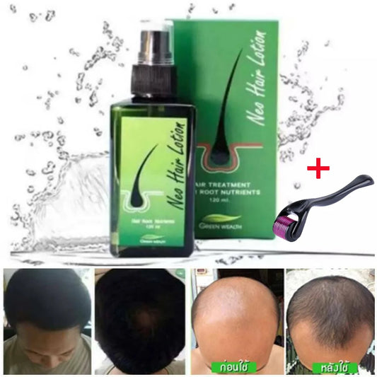 Ali Hair Treatments Neo Hair Lotion 120ml Hair Treatment Hair Root  Anti-Loss Beard Regrowth Original Thailand